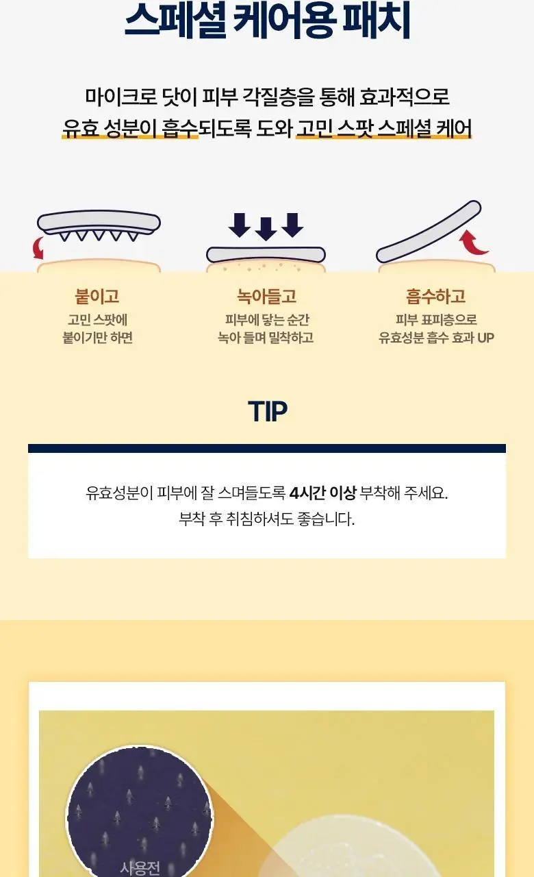 [맞춤형집중패치] 케어플러스 마이크로 닷 패치 3종 [징크트러블/글루타치온미백/레티날모공] 연합 상세페이지 25